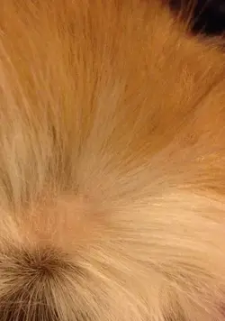 hairloss1.webp