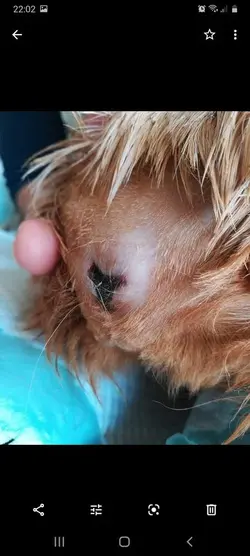 After 1st ssurgery.webp