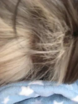 Betsy hair loss 3.webp