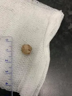 Teggy, urethral stone 2020 size.jpg Teggy, urethral stone 2020 size.jpg