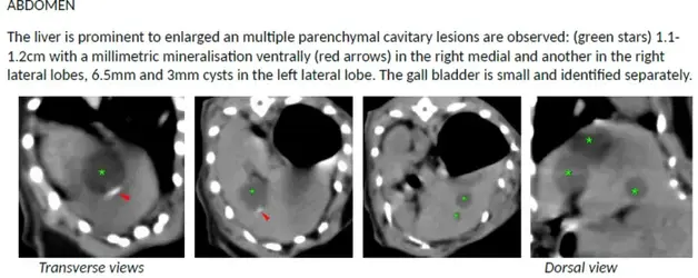 ct liver.PNG