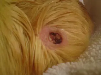 cyst wound.webp