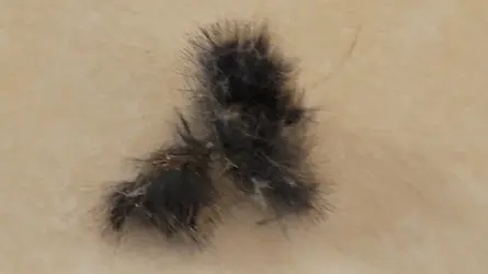 Hair clump.webp Hair clump.webp