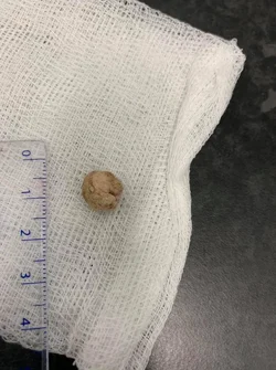 Teggy, urethral stone 2020 size.webp Teggy, urethral stone 2020 size.webp