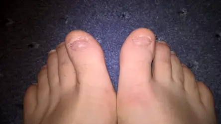 toes.webp