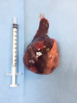 Bitsy's Splenic Tumour 2017-01-12.webp